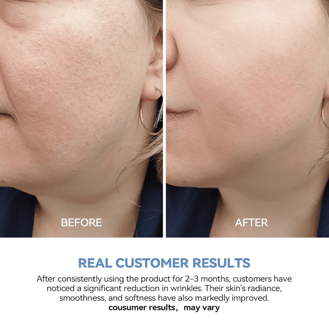 Deep Hydrating 'Anti-Wrinkles' Serum with 3% Hyaluronic Acid
