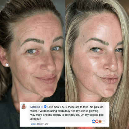 Liposome Glutathione Strips (30 Days)