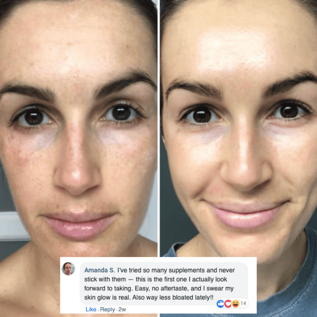 Liposome Glutathione Strips (30 Days)