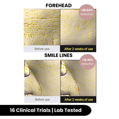 Korean Silk Collagen & Peptide Face-Lift Duo