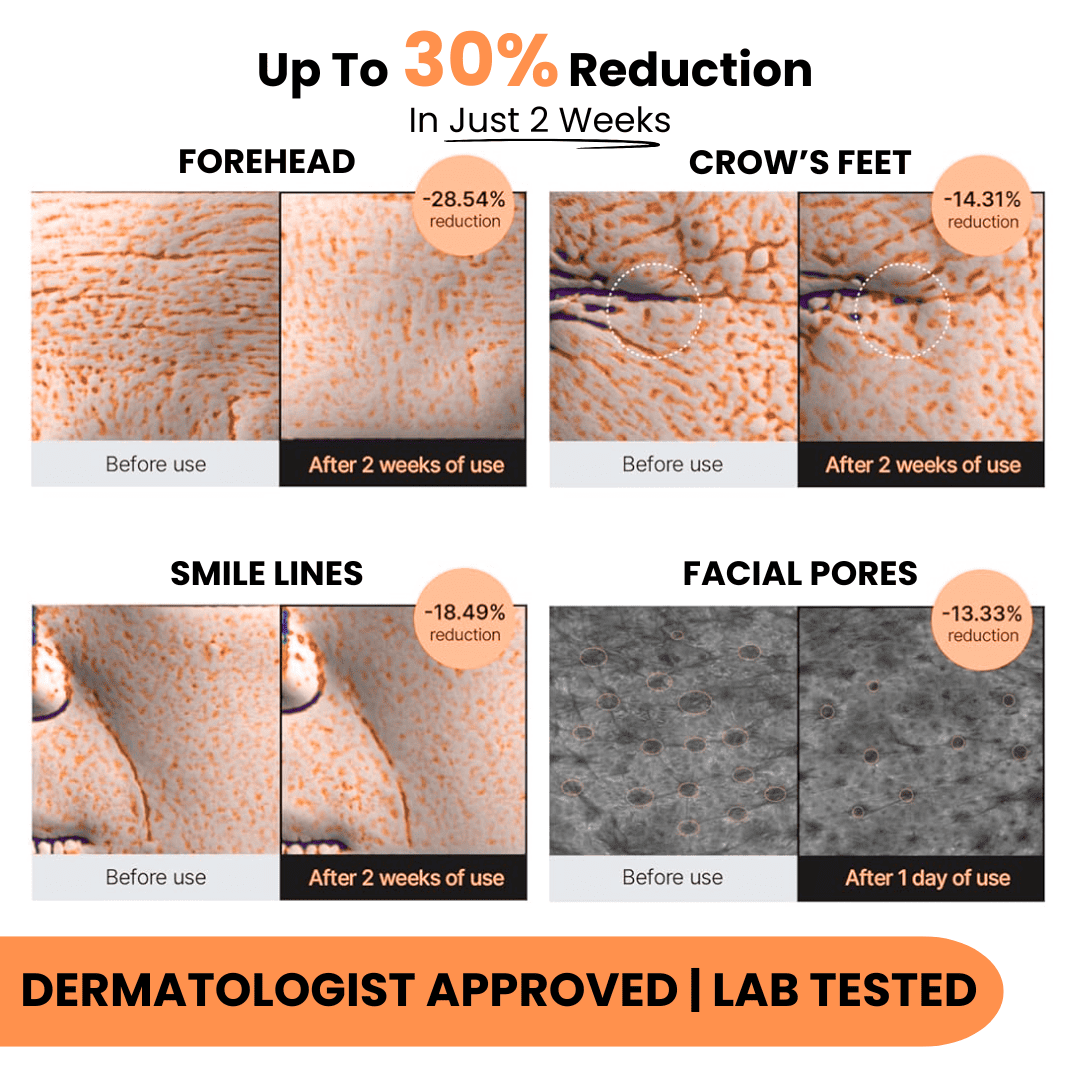 Liposome Glutathione Strips (30 Days)