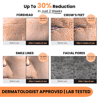 Liposome Glutathione Strips (30 Days)